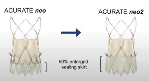 Figure 1 : comparaison des valves ACURATE neo et ACURANTE neo2