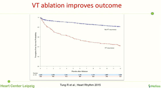 L’ablation par radiofréquence de TV 