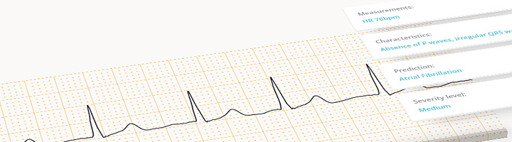 Cardiologs