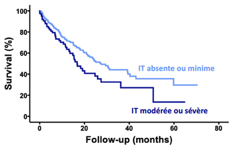 Figure 3 : courbes de survie des patients atteints d’amylose cardiaque en fonction de la sévérité de l’insuffisance tricuspide