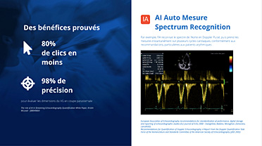 AI Auto Measure – Spectrum Recognition