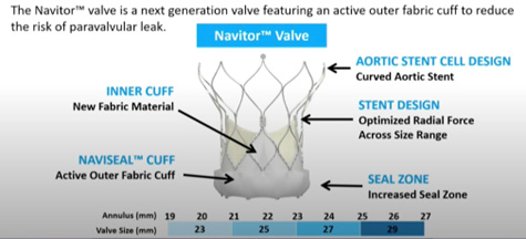 Figure 1 : présentation de la bioprothèse NAVITORTM (Abbott)