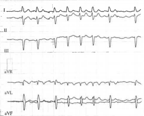 Le-coeur-a-ses-raisons-que-la-jugulaire-ne-connaît-point-figure1.png