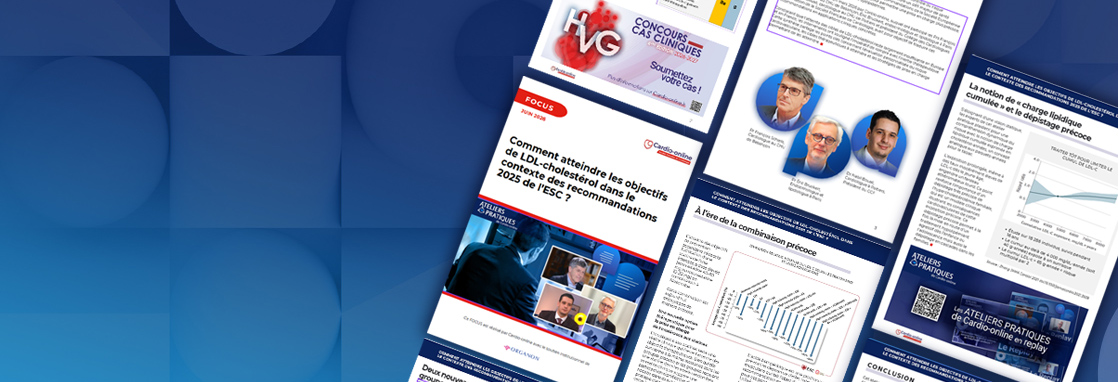 FOCUS-Comment-atteindre-les-objectifs-de-LDL-cholest&eacute;rol-Bandeau-page