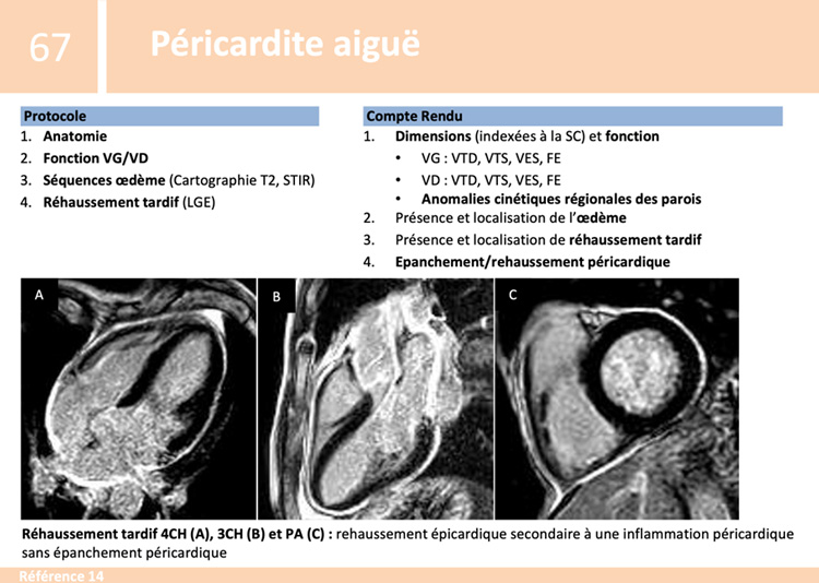 Fiche de synthèse : IRM cardiaque - 3