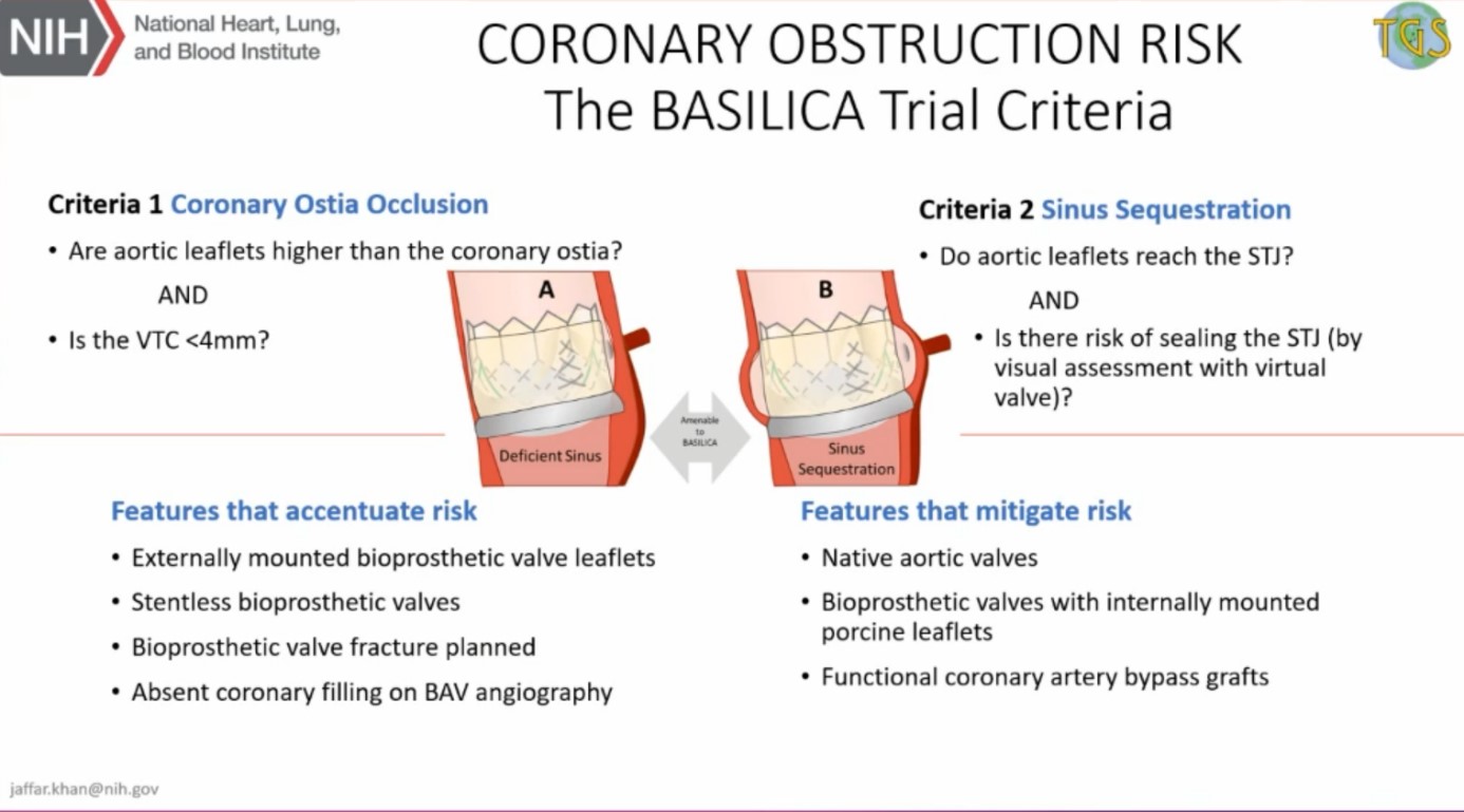 The Basilica trial criteria