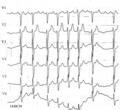 Le-coeur-a-ses-raisons-que-la-jugulaire-ne-connaît-point-figure2.jpg