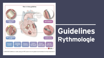 Recommandations ESC 2021 : la stimulation cardiaque et la resynchronisation