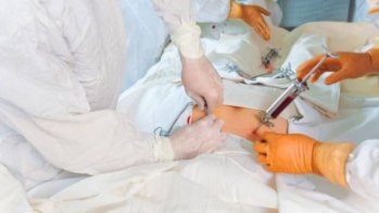 L'hypertension fréquente chez les personnes ayant eu une greffe hématopoïétique