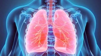 Le risque de cancer du poumon augmente de 14% avec les IEC par rapport aux ARA II