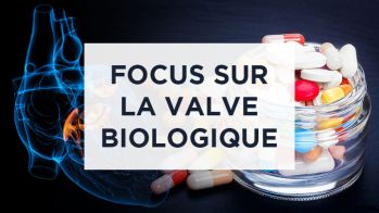 AOD et valve biologique