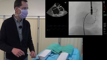 Interventionnel : comment réaliser une ponction transseptale