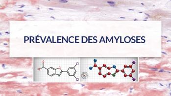 L’amylose cardiaque à transthyrétine dans le rétrécissement aortique