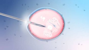 Le risque de cardiopathie congénitale majeure est augmenté chez les enfants issus de FIV ou d'Icsi