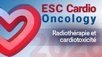 Radiothérapie : la cardiotoxicité appartient-elle au passé ?