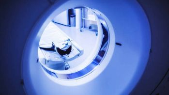 Maladie coronaire familiale : le score calcique combiné à un traitement préventif est bénéfique chez les patients à risque intermédiaire