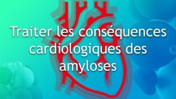 Traiter les conséquences cardiologiques des amyloses