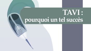 TAVI : pourquoi un tel succès ?