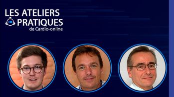 AVC cryptogénique, jusqu'où "traquer" la FA ? 