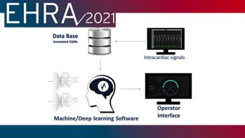 EHRA 2021 : perspectives et nouvelles technologies en matière d'ablation de FA