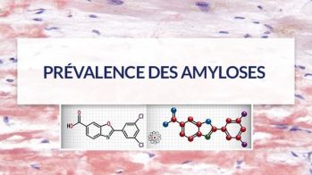 La prévalence des amyloses cardiaques déterminée par la fixation cardiaque à la scintigraphie osseuse chez le patient âgé 