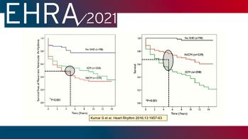 EHRA 2021 : controverses dans le traitement des arythmies ventriculaires