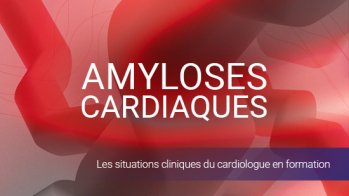 Amyloses cardiaques, les situations cliniques du cardiologue en formation