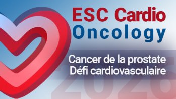 Cancer de la prostate : un défi cardiovasculaire majeur