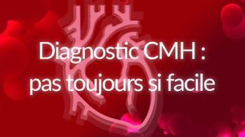 Diagnostic de la cardiomyopathie hypertrophique : pas toujours si facile !
