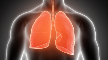 Embolie pulmonaire : plus de complications quand les anticoagulants oraux directs ne sont pas au bon dosage