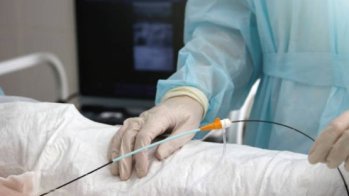 Intérêt de l'ablation par température ultabasse dans la tachycardie ventriculaire dans les maladies cardiaques structurales