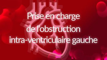 La prise en charge de l’obstruction intra-ventriculaire gauche