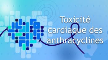 Toxicité cardiaque des anthracyclines : faut-il prescrire une statine ?