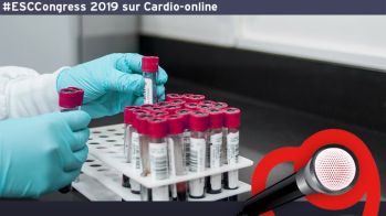 Recommandations ESC 2019 : Dyslipidémies