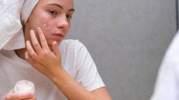 Acné : des dermatologues appellent à cesser la surveillance biologique de routine des patients sous isotrétinoïne