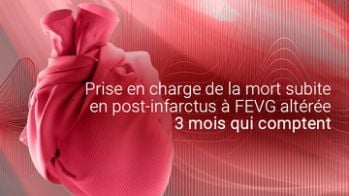 Prise en charge de la mort subite en post infarctus à FEVG altérée : 3 mois qui comptent