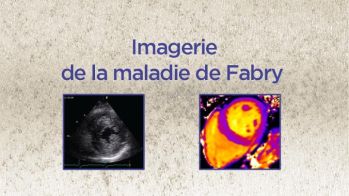 Imagerie de la maladie de Fabry : l'échocardiographie