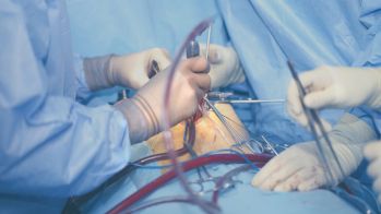 Première xénogreffe cardiaque : un rejet atypique, la cause infectieuse encore non démontrée