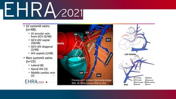 EHRA 2021 : que faire en cas d’échec de l’ablation conventionnelle de tachycardie ventriculaire ?
