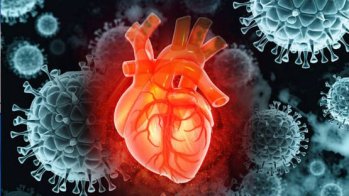 Forte hausse du risque d'endocardite infectieuse chez les patients sujets à certaines pathologies cardiaques en France