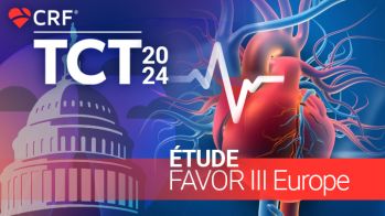 La QFR ne rivalise pas avec la FFR pour guider les revascularisations