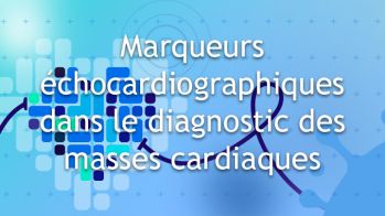 Marqueurs échocardiographique dans le diagnostic des masses cardiaques