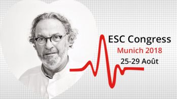Résultats de l'étude ACST à 15 ans sur la chirurgie des sténoses carotidiennes asymptomatiques