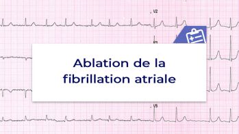 Ablation de la FA