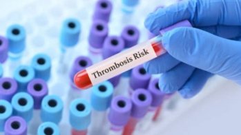 Risque hémorragique accru avec un traitement antithrombotique au long cours après un AVC chez les patients jeunes
