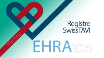 Stimulateur cardiaque après TAVI : résultats à long terme (SwissTAVI)