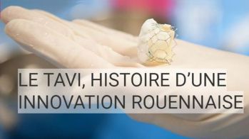 Les webinars du CNCH : le TAVI, histoire d'une innovation rouennaise