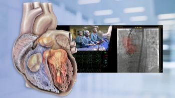 TAVI valve-in-valve : état des lieux à EuroPCR 2021