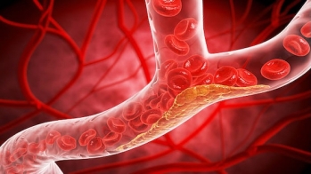 Pratiquement toutes les personnes développant une maladie cardiovasculaire ont au moins un facteur de risque non optimal