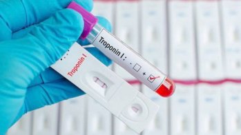 Suspicion d'infarctus : un test de troponine réalisé au domicile évite le transport aux urgences dans un tiers des cas